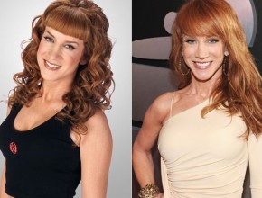 Kathy Griffin before and after plastic surgery (10)