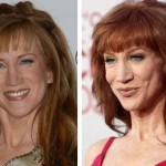 Kathy Griffin before and after plastic surgery (11)