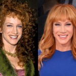 Kathy Griffin before and after plastic surger