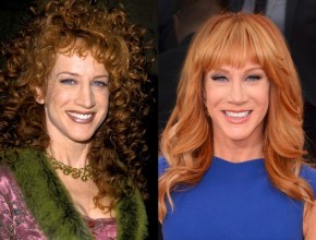 Kathy Griffin before and after plastic surger