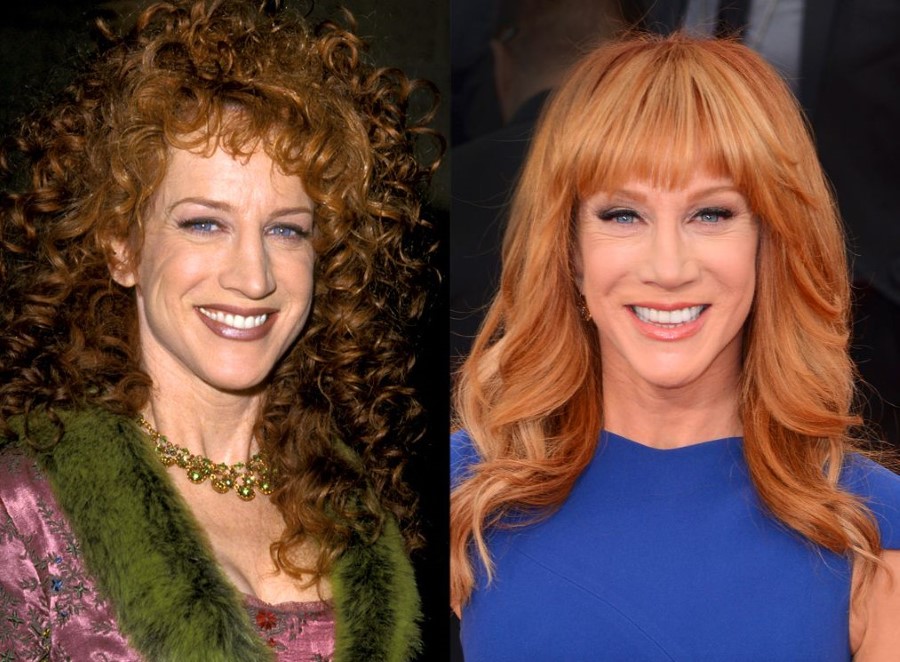 Kathy Griffin before and after plastic surger