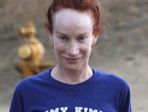 Kathy Griffin plastic surgery (13)