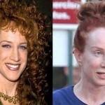 Kathy Griffin plastic surgery (19)