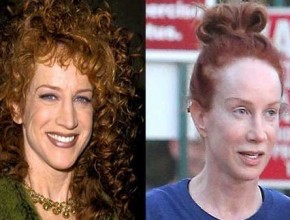 Kathy Griffin plastic surgery (19)