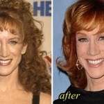 Kathy Griffin plastic surgery (20)