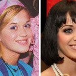 Katy Perry before and after plastic surgery (12)