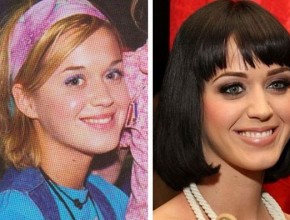Katy Perry before and after plastic surgery (12)