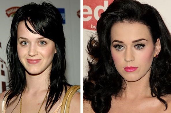 Katy Perry before and after plastic surgery