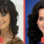 Katy Perry before and after plastic surgery (31)