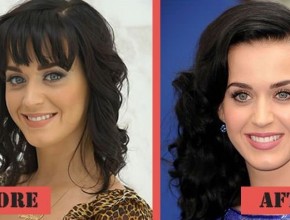 Katy Perry before and after plastic surgery (31)