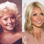 Kelly Ripa before and after plastic surgery (1)