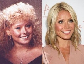 Kelly Ripa before and after plastic surgery (1)