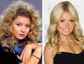 Kelly Ripa before and after plastic surgery