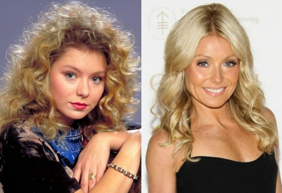 Kelly Ripa before and after plastic surgery