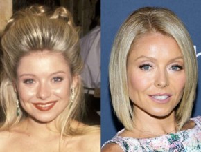 Kelly Ripa before and after plastic surgery (13)