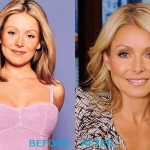 Kelly Ripa before and after plastic surgery (20)