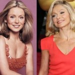Kelly Ripa before and after plastic surgery (6)
