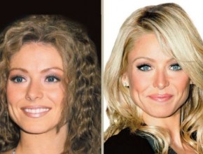 Kelly Ripa before and after plastic surgery (9)
