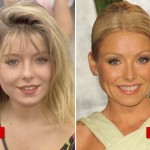 Kelly Ripa plastic surgery (19)