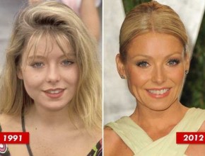 Kelly Ripa plastic surgery (19)