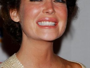Lara Flynn Boyle after lip plastic surgery