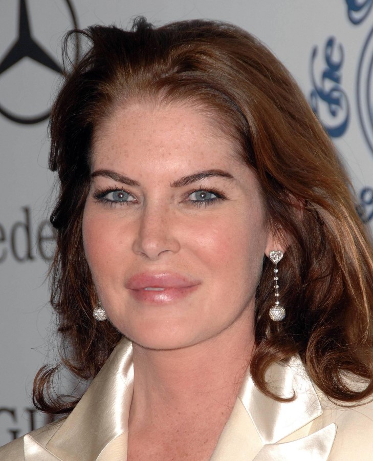 Lara Flynn Boyle after plastic surgery (16)