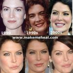 Lara Flynn Boyle after plastic surgery