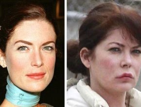 Lara Flynn Boyle after plastic surgery