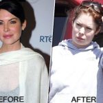Lara Flynn Boyle after plastic surgery