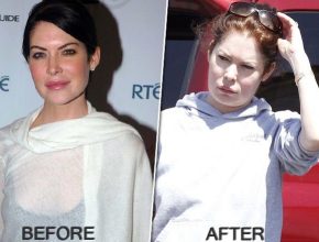 Lara Flynn Boyle after plastic surgery