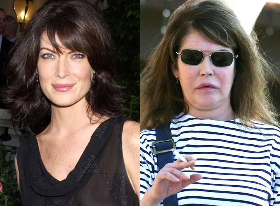 Lara Flynn Boyle before and after plastic surgery