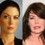 Lara Flynn Boyle after plastic surgery