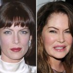 Lara Flynn Boyle after plastic surgery