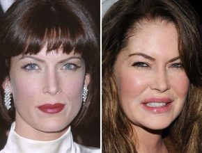 Lara Flynn Boyle after plastic surgery