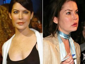 Lara Flynn Boyle after plastic surgery