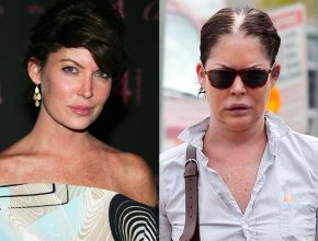 Lara Flynn Boyle after plastic surgery