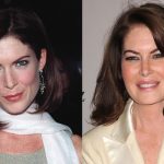 Lara Flynn Boyle before and after plastic surgery