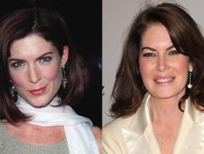 Lara Flynn Boyle before and after plastic surgery