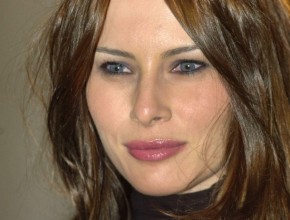 Melania Trump plastic surgery (26)