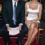 Melania and Donald Trump plastic surgery (18)