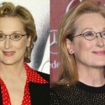 Meryl Streep before and after plastic surgery (13)