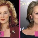 Meryl Streep before and after plastic surgery (19)