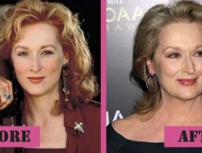Meryl Streep before and after plastic surgery (19)