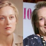 Meryl Streep before and after plastic surgery (26)