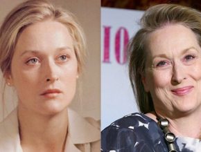 Meryl Streep before and after plastic surgery (26)