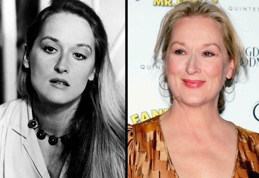 Meryl Streep before and after plastic surgery