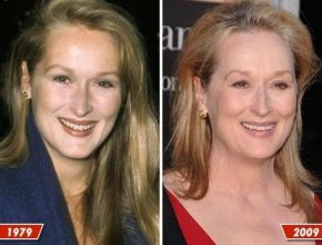 Meryl Streep before and after plastic surgery (7)