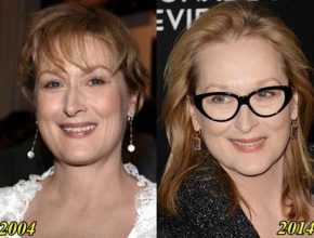 Meryl Streep before and after plastic surgery (8)