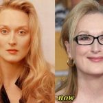 Meryl Streep before and after plastic surgery (9)