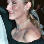 Meryl Streep plastic surgery (10)